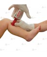 Pistola para Inyección Intraosea pediátrica