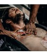 Apósitos oclusivos para heridas abiertas de tórax con válvula