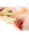 kit aguja de descompresión neumotórax TPAK