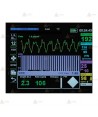 Monitor/Desfibrilador profesional X Series de Zoll